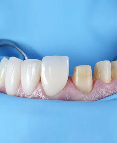 dental dam in joplin