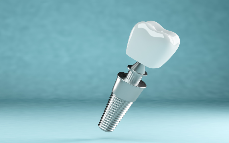 difference between dental implants and mini dental implants