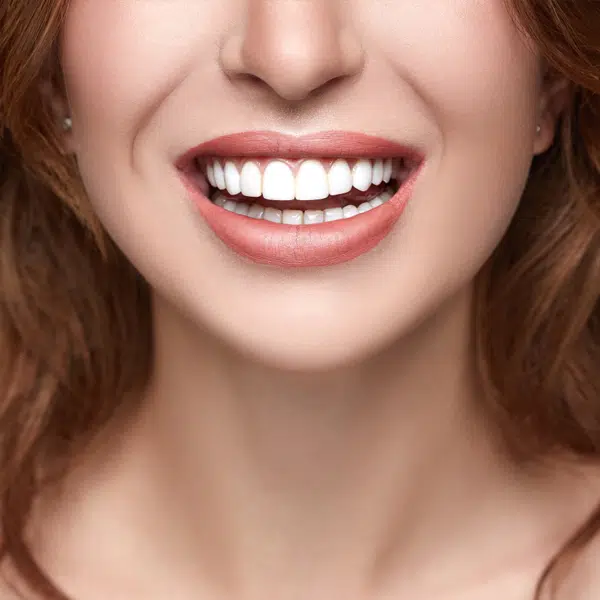 dental fillings in joplin