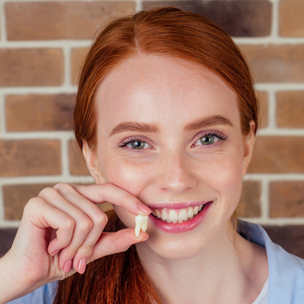 dental fillings in joplin